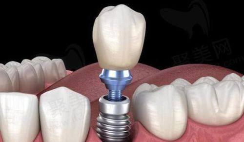 湖南长沙达飞口腔医生名单及擅长领域：