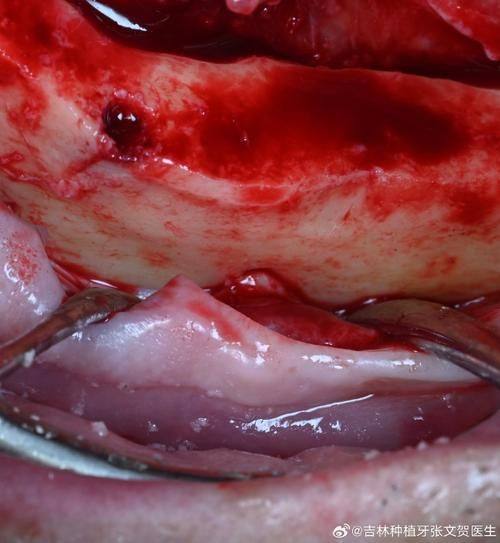 拜博口腔诊所擅长项目: