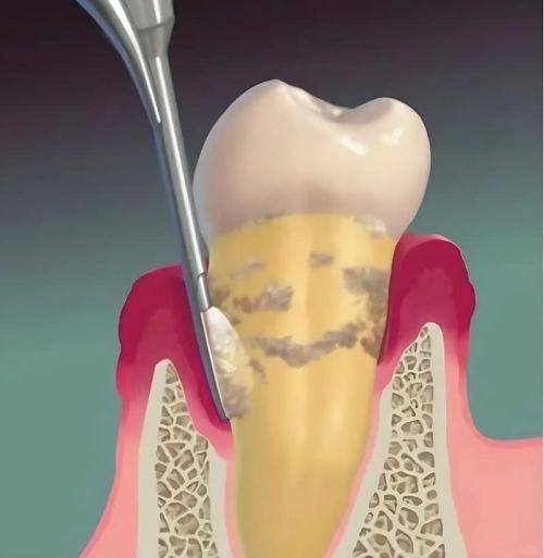 广东广州美诺囗腔地址电话及营业时间