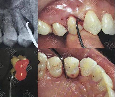 广东广州美诺囗腔价格表