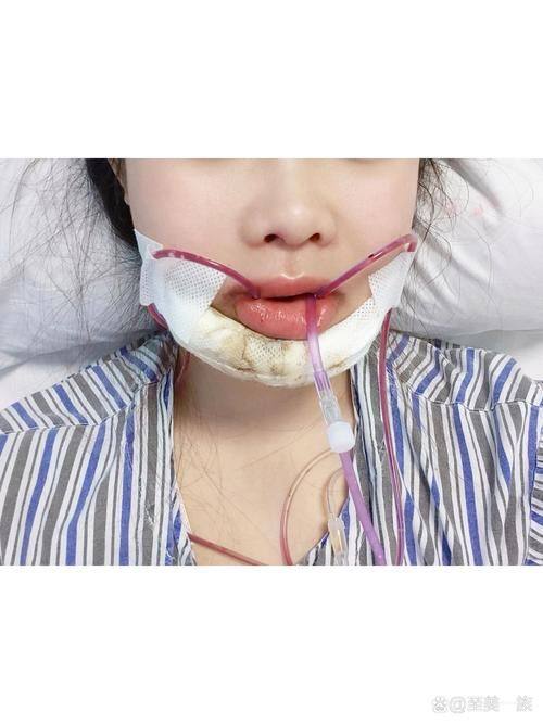 王永超医生技术优势