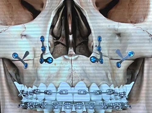 徐元瑞医生技术优势