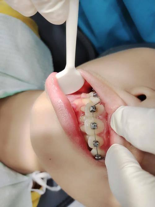 哈尔滨鲸鱼口腔门诊口碑评价：