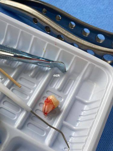 广东广州美诺囗腔预约挂号方式