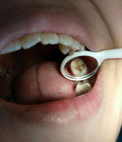 哈尔滨鲸鱼口腔门诊擅长项目：