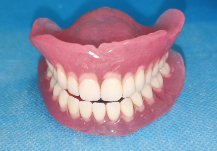 三、北京京大博爱口腔门诊部美国皓圣种植牙真实实例分享