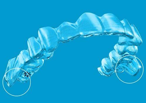 三、洗牙之后第二天刷牙出现酸痛该怎么应对