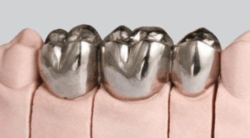 二、成人龅牙可以矫正吗