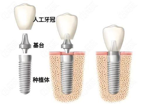 辽宁营口马国彬口腔口碑评价：