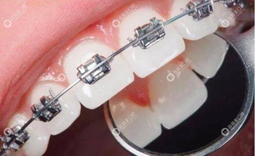 河北石家庄正定唯牙美口腔口碑评价：