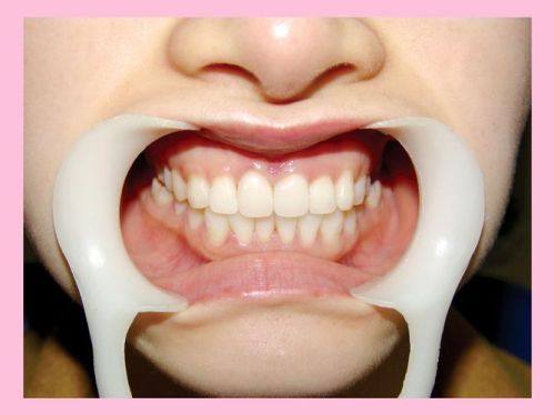 重庆黔江周光琴口腔预约挂号方式: