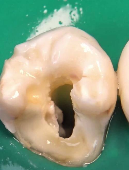 朱文杰医生怎么预约