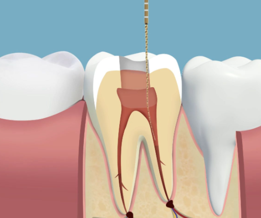 陕西汉中勉县董金枝口腔擅长项目：