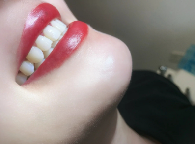 五、6岁小孩拔牙后的护理细节