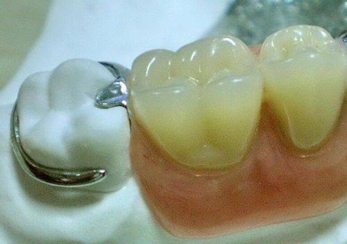 五、血糖9的人想拔牙，该怎么做？正确的应对步骤