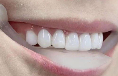 三、为什么空腹血糖9不建议拔牙？背后的临床逻辑