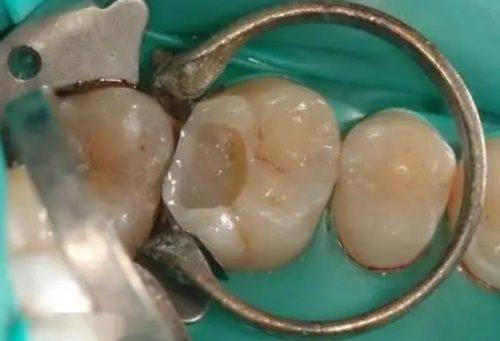 潍坊高新贾艳玲口腔怎么样？