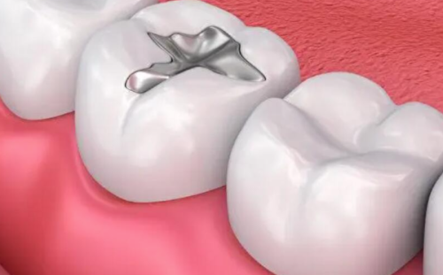 深圳牙力仕口腔诊所(光明店)口碑评价：