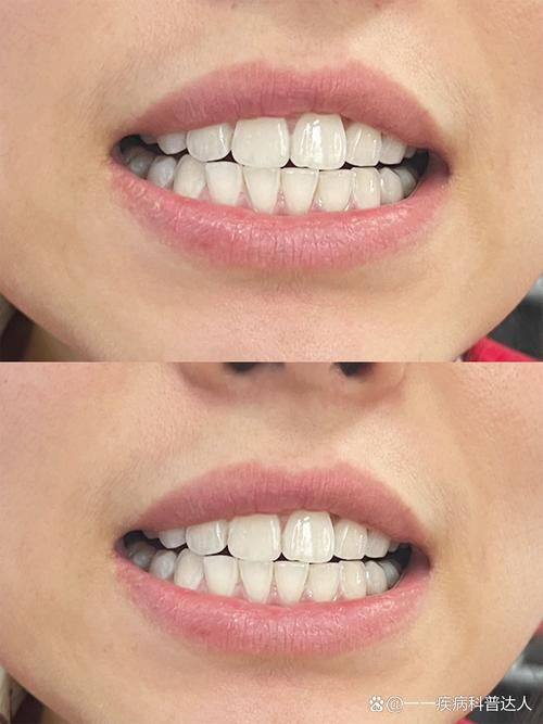 潍坊高新贾艳玲口腔价格表：