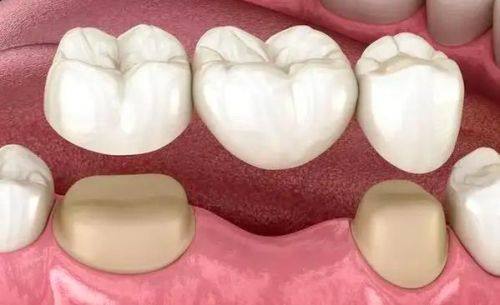 银川艾齿口腔医院擅长项目