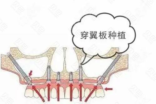 张士杰医生怎么预约