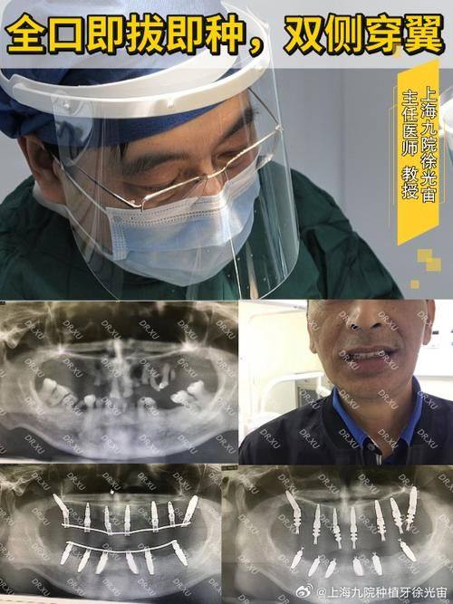 张士杰医生口碑评价