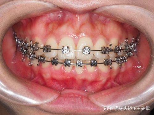 山东省济南市平阴健雅口腔怎么样？