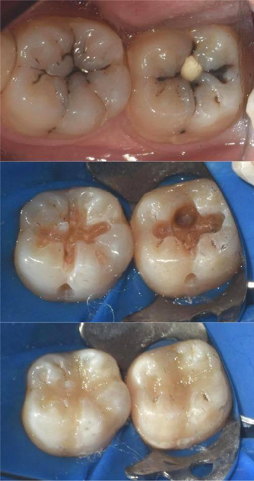 吴忠市青铜峡惠众口腔诊所价格表