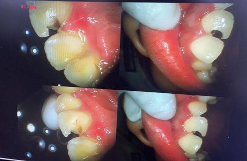 牛纪霞医生技术优势