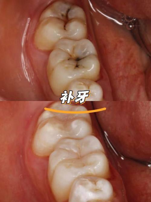 厦门市第五医院口腔科口碑评价:
