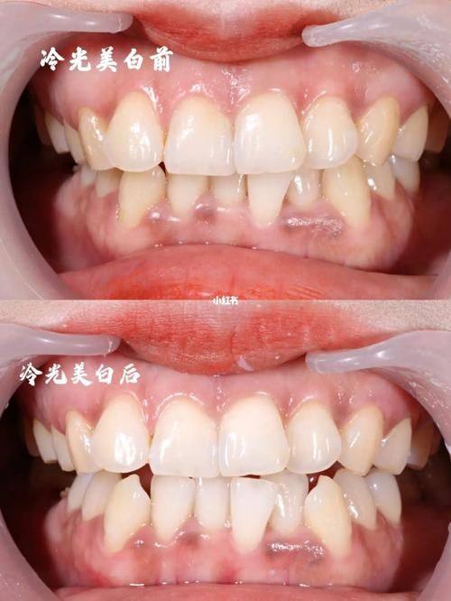 南通崇川东城口腔诊所地址电话及营业时间：