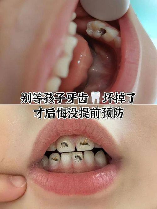 吴忠市青铜峡惠众口腔诊所怎么样?
