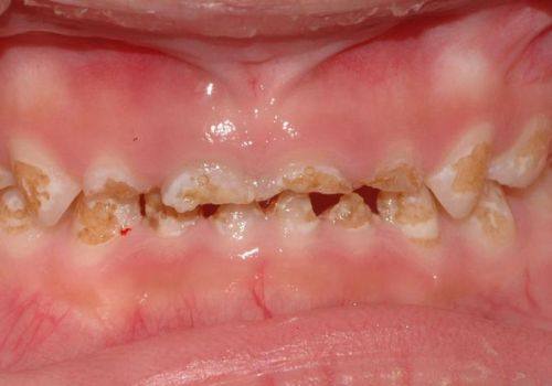 吴忠市青铜峡惠众口腔诊所预约挂号方式