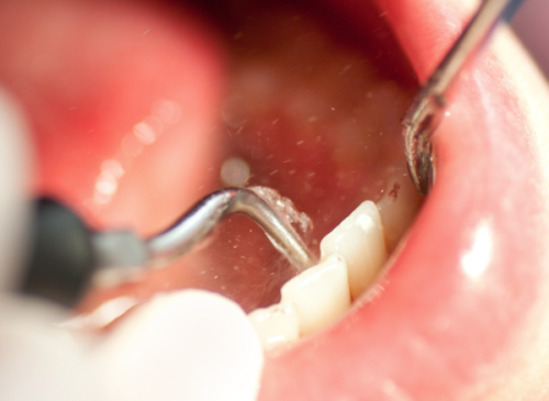 安顺市妇幼保健院口腔科门诊价格表