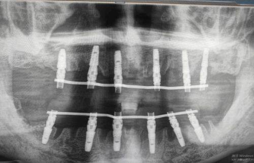 陈琰医生口碑评价