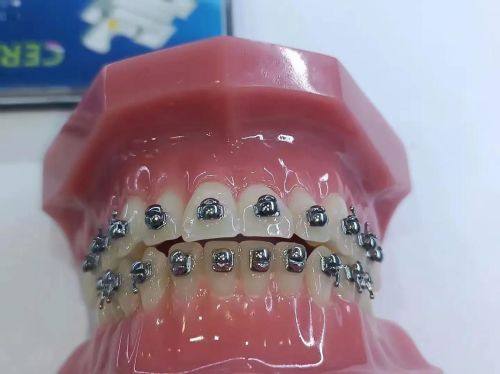 沈阳奥齿口腔诊所擅长项目：