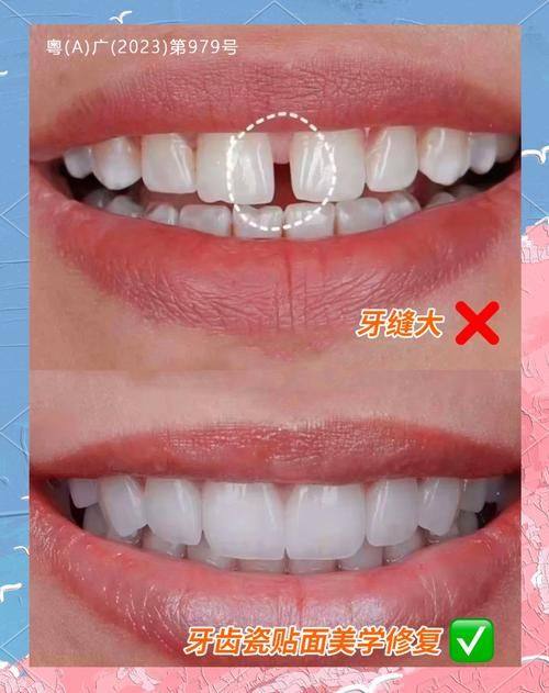 邓卫国医生技术优势