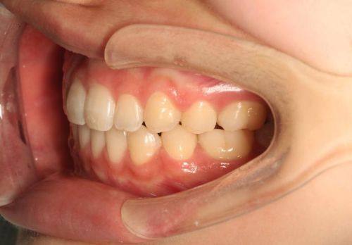 吴世莲医生怎么预约