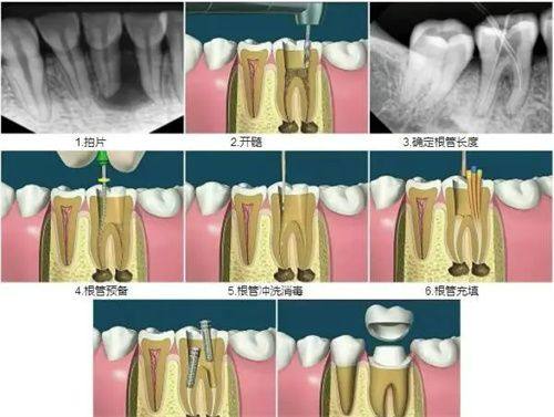 浙江海宁圣麦口腔连锁价格表：