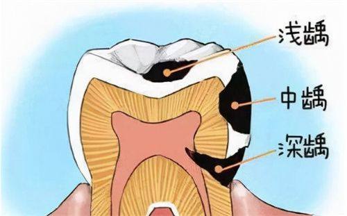 江西上饶鄱阳贝齿口腔口碑评价：