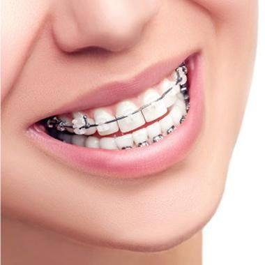 江西上饶鄱阳贝齿口腔价格表：