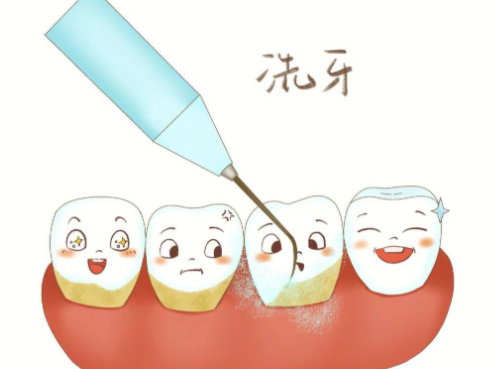 三、拔牙细节与矫治方案：影响收缝时长的关键变量