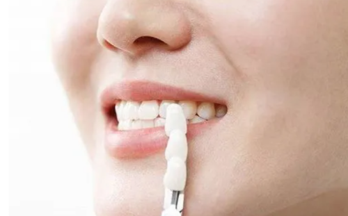 三、美观+健康双重收益,30岁正畸是刚需改善