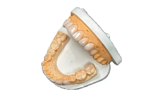 四、非正规操作才是洗牙损伤牙齿的“罪魁祸首”