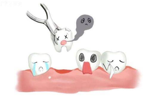 三、网传“洗牙损害牙齿”的常见误区解析