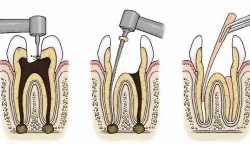 张本娟医生口碑评价：