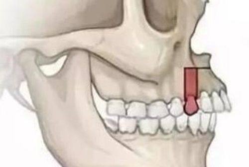 五、地包天的女人财运好吗？财运由个人能力与机遇决定