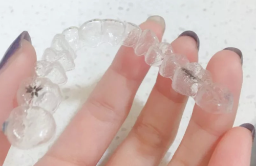 六、洗牙的关键注意事项：选对机构是核心