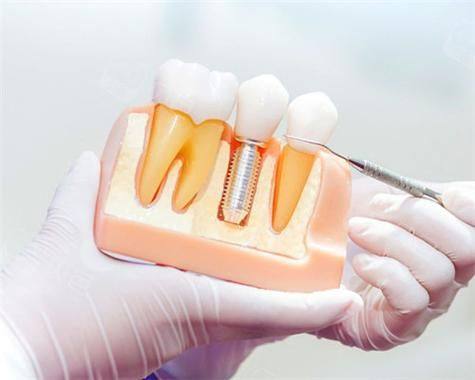 深圳雅仕口腔诊所地址电话及营业时间