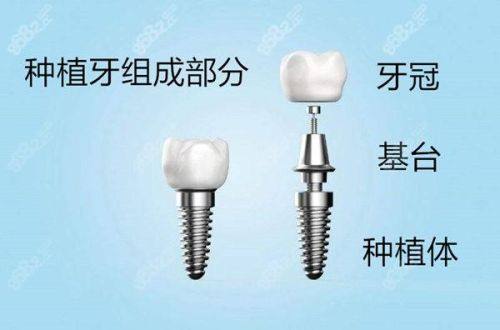 宁夏中卫中宁精艺口腔地址电话及营业时间: